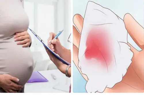 Máu dọa sảy thai, máu báo thai sắp sinh là gì?